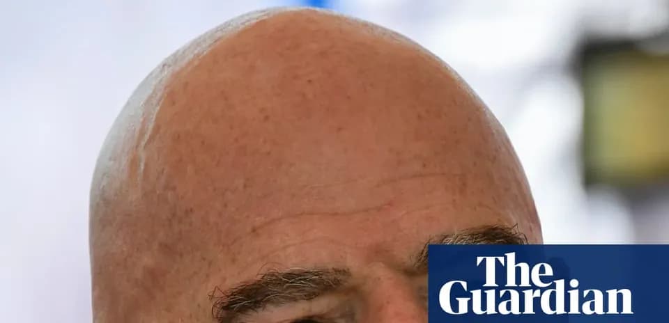 Close-up of a bald man's head and eyes